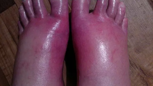 Pain Institute of Southern Arizona