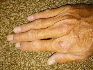 Nailed to a T