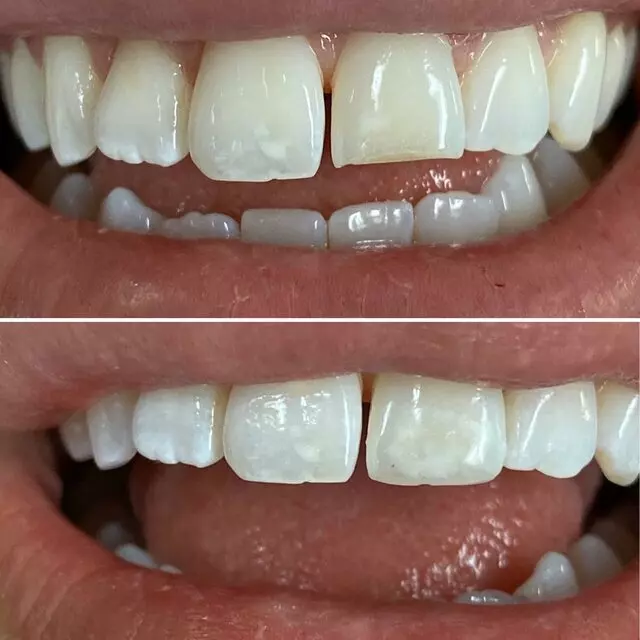 Alexa Carrara Benzell, DDS - Campbell Dental Group